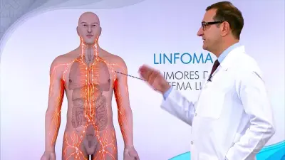 Conheça os sintomas do linfoma não-Hodgkin